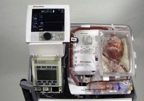 Ученые разработали аппарат для сохранения работоспособности сердца вне тела